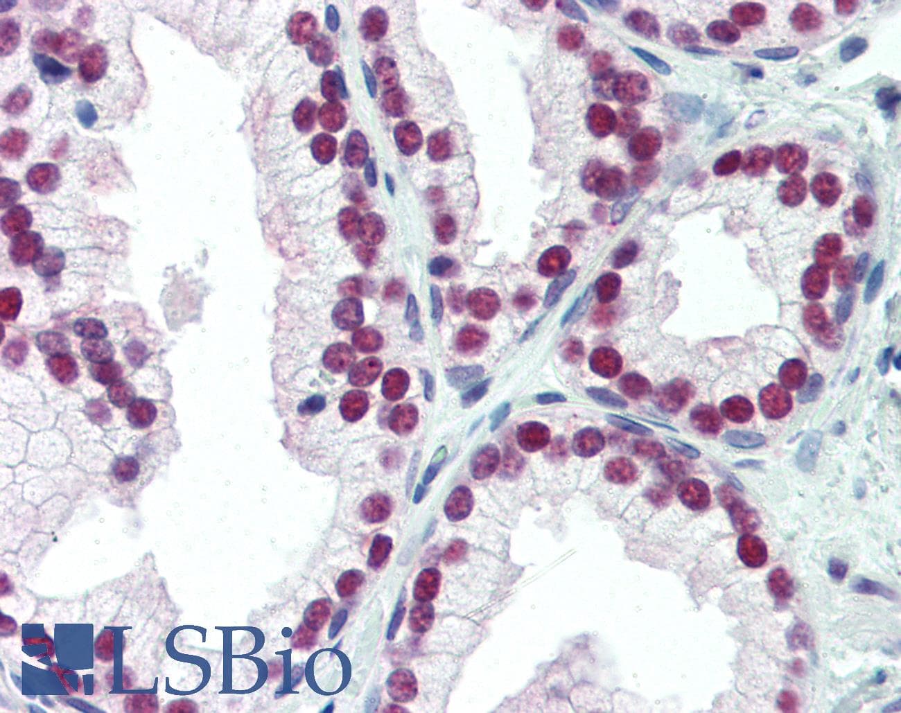 IHC-plus™ Monoclonal Mouse anti-Human NKX3-1 Antibody (clone 3-9, N-Terminus, IHC, WB)