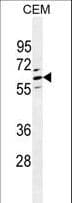 Polyclonal Rabbit anti-Human CLEC4F Antibody (aa311-339, IHC, WB)