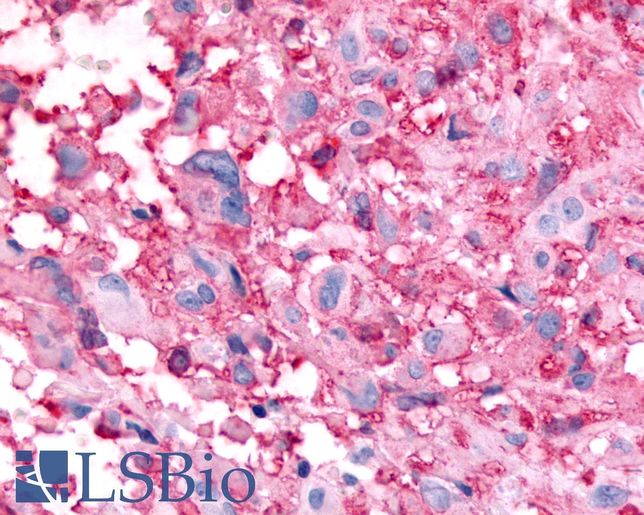 PathPlus™ Polyclonal Rabbit anti-Human GPR32 Antibody (Extracellular Domain, IHC)