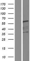 NAG20 / UBAP1 Protein (Over-Expression Lysate Myc-DDK (Flag))