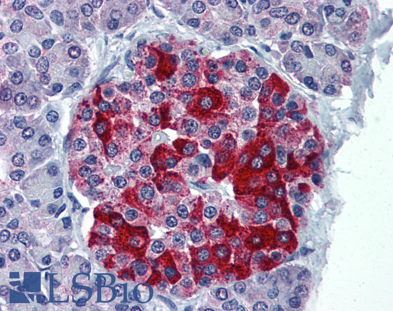IHC-plus™ Monoclonal Mouse anti-Human RBP4 Antibody (clone 3D12, IHC, WB)