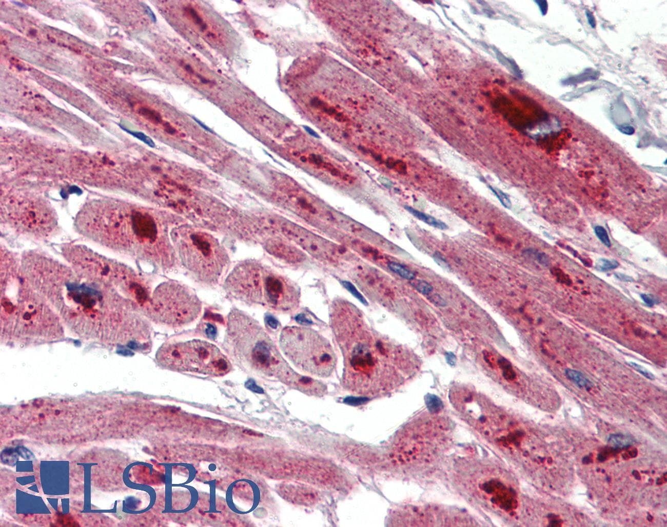 IHC-plus™ Polyclonal Rabbit anti-Human ASAH1 / Acid Ceramidase Antibody (IHC, IF, WB)