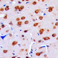 DUSP16 / MKP7 Antibody (C-Terminus)