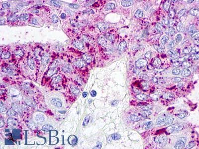 PathPlus™ Polyclonal Rabbit anti-Human GPR26 Antibody (Extracellular Domain, IHC)