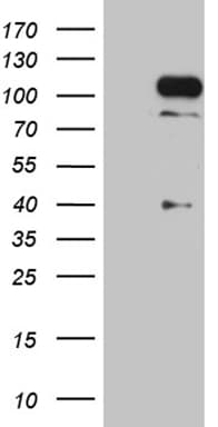 TCF12 / HEB Antibody (clone OTI3C11)
