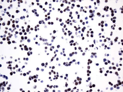 FOXP1 Antibody (clone UMAB242)