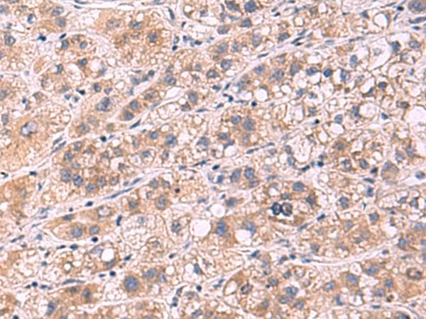 Polyclonal Rabbit anti-Human PPEF / PPEF1 Antibody (IHC, WB)