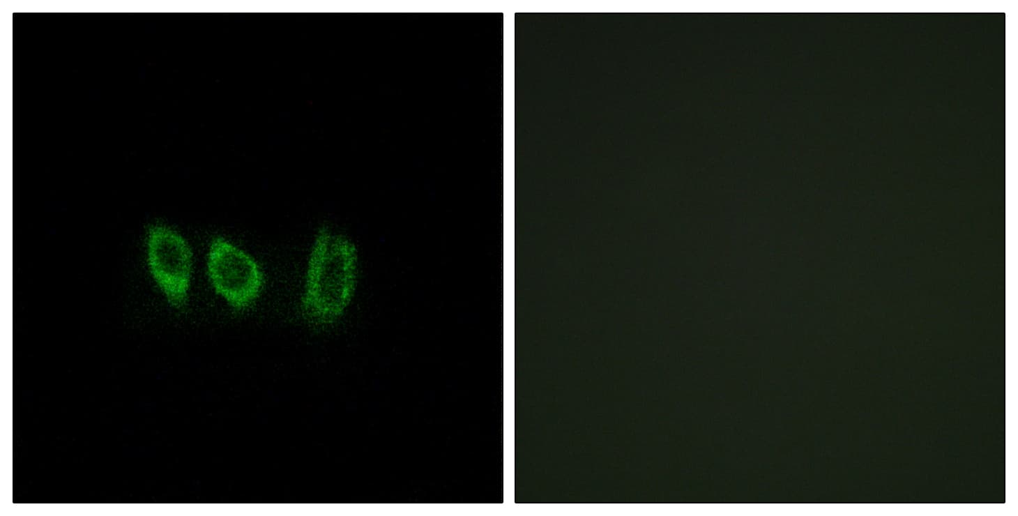 CSTL1 / Cystatin-Like 1 Antibody (aa61-110)