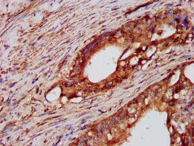 Polyclonal Rabbit anti-Human PTPN3 Antibody (IHC, IF)