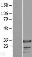FHL2 Protein (Over-Expression Lysate Myc-DDK (Flag))
