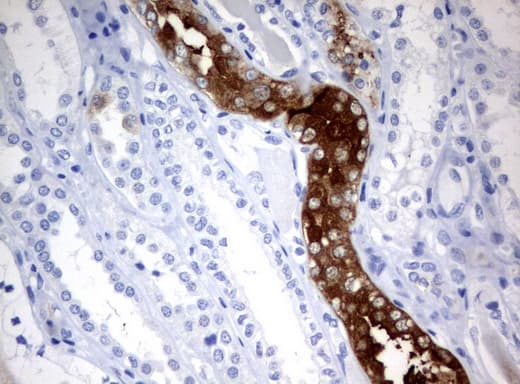 FTCD / 58K Golgi Protein Antibody (clone UMAB123)