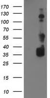 BAIAP2 / IRSP53 Antibody (clone OTI 1D9)