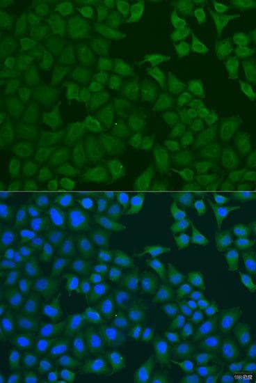 URP2 / FERMT3 Antibody