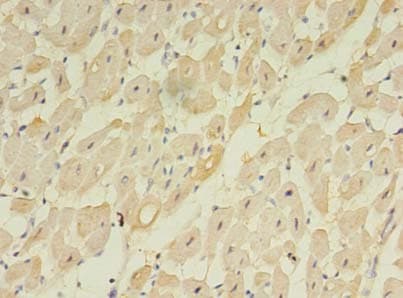 TMEM222 Antibody