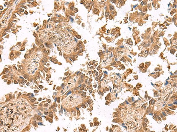 PTHR / PTHR1 Antibody