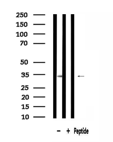 MRPL15 Antibody