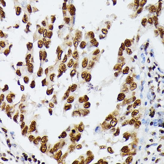 HNRNPD / AUF1 Antibody