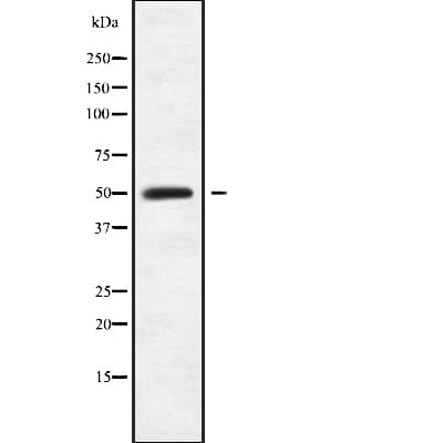 Polyclonal Rabbit anti-Human P3H4 / LEPREL4 Antibody (WB)