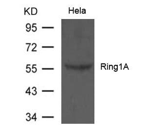 RING1 Antibody