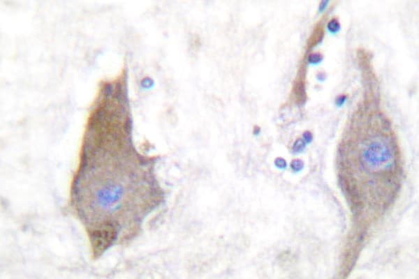 Synuclein Antibody (aa19-30)