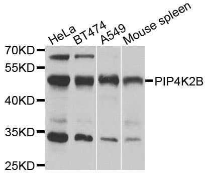 PIP4K2B Antibody