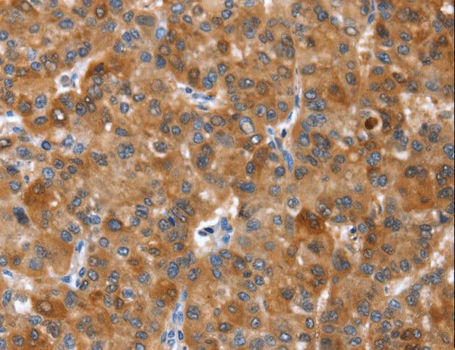 NOD2 / CARD15 Antibody