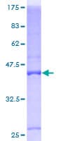 Human BTG1 Protein (Recombinant GST)