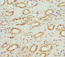 NDUFS1 Antibody