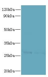 FAM71C Antibody