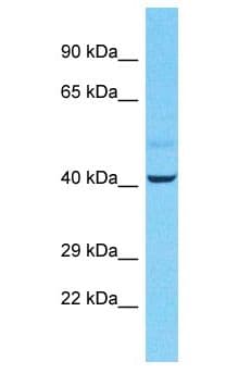 STAU2 Antibody (aa206-255, HRP)