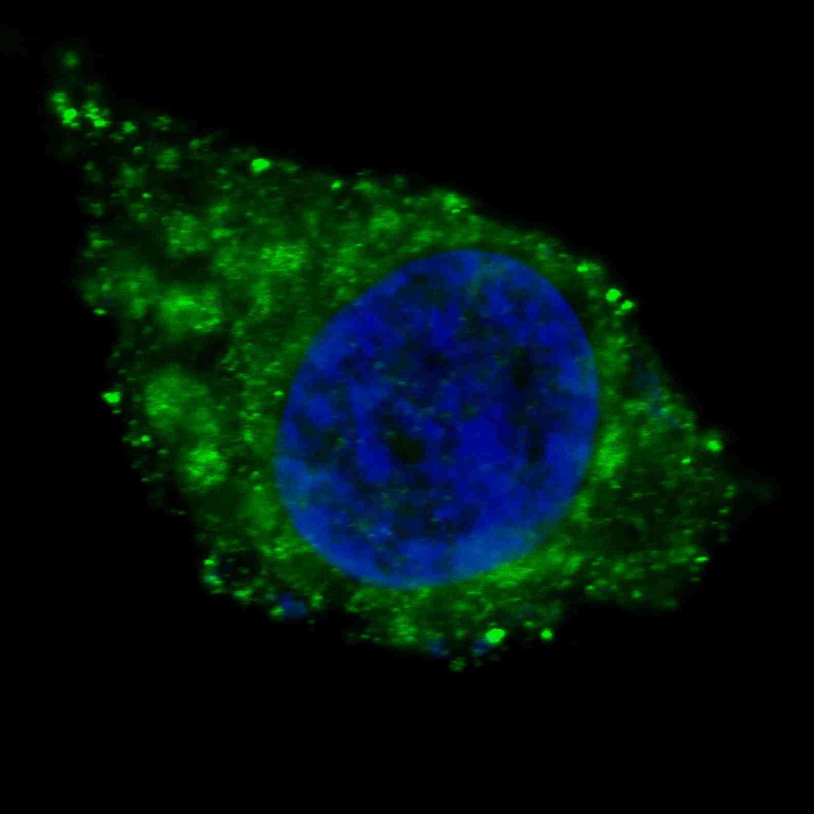 PathPlus™ ALDH1A1 / ALDH1 Antibody