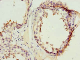Polyclonal Rabbit anti-Human PPP2R1B Antibody (IHC, WB)