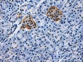 HDAC10 Antibody (clone OTI6D4)