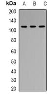 RB1 / Retinoblastoma / RB Antibody (C-Terminus)