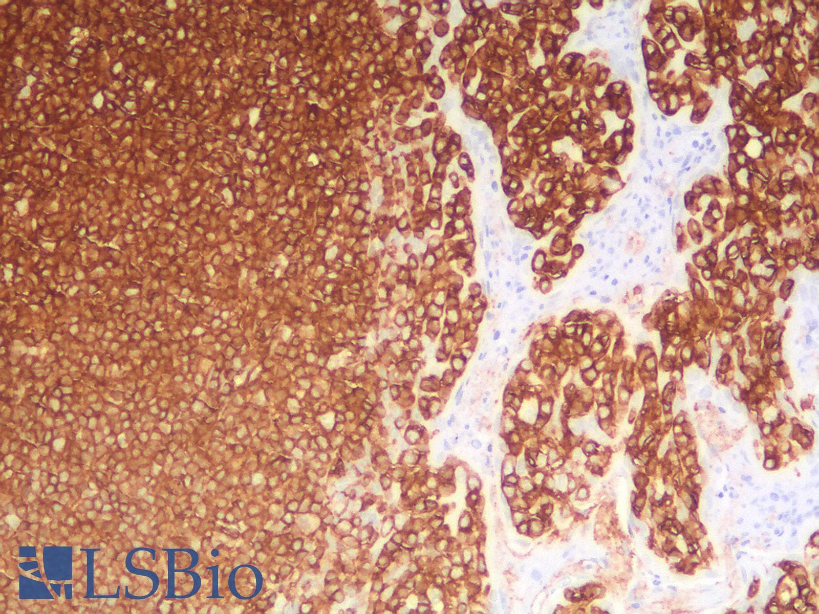 PathPlus™ CD45 / LCA Antibody (clone PTPRC/1783R + PTPRC/1975R)