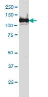 IHC-plus™ BUB1B / BubR1 Antibody (clone 3F2)