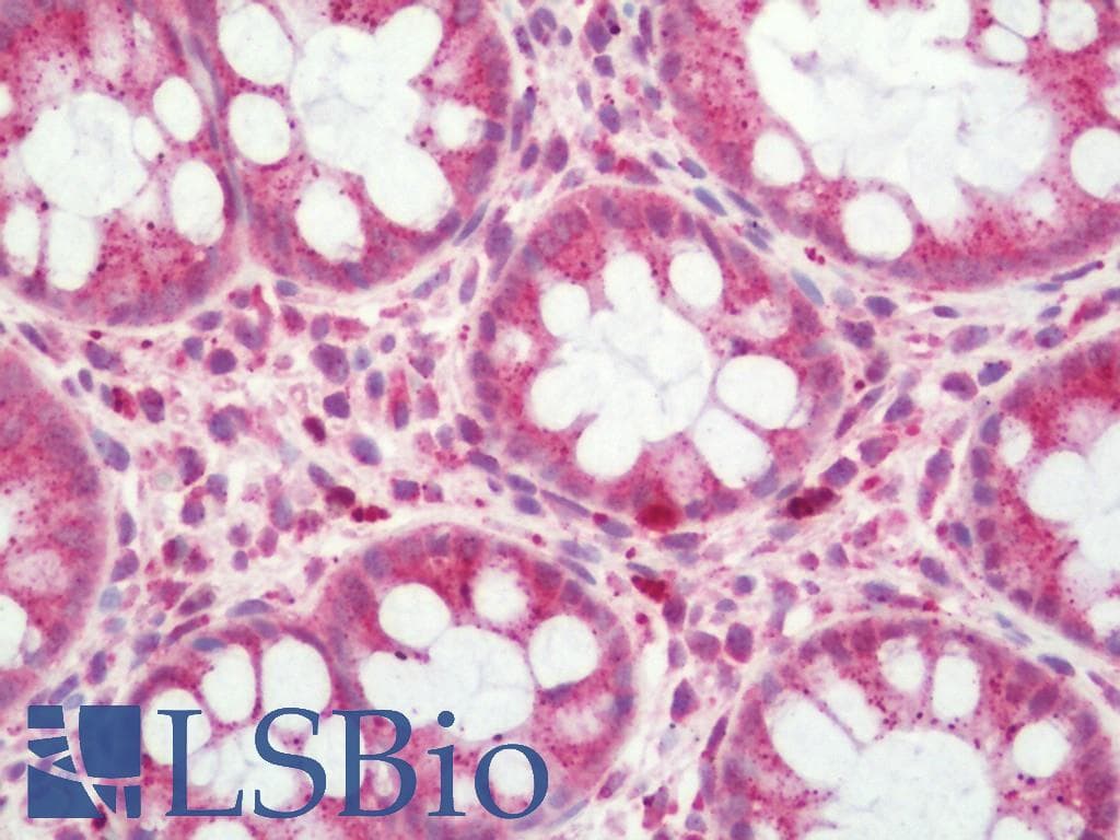 PathPlus™ VR1 / TRPV1 Antibody