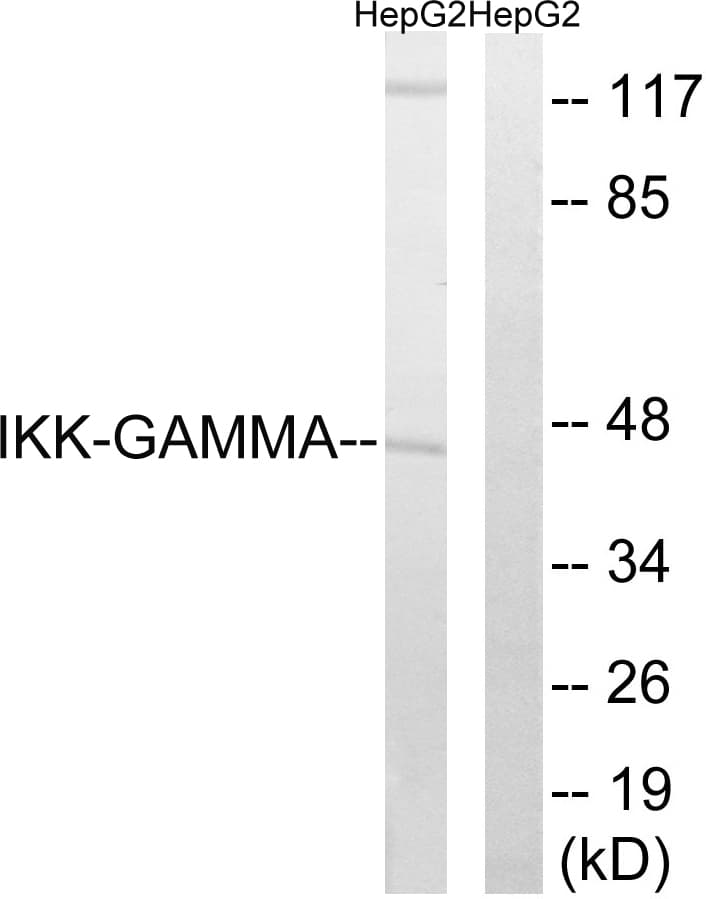 IKBKG / NEMO / IKK Gamma Antibody (aa16-65)
