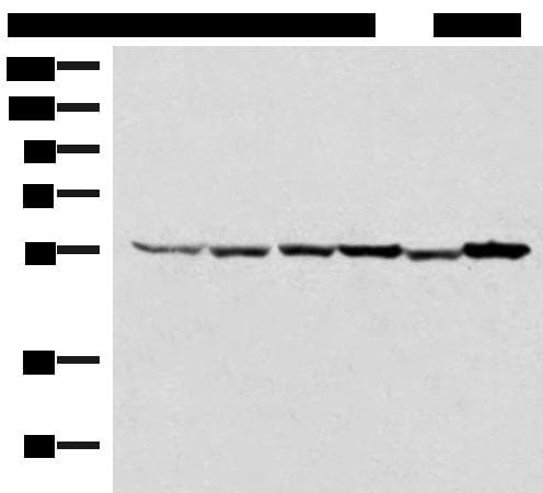 TIP49 / RUVBL1 Antibody