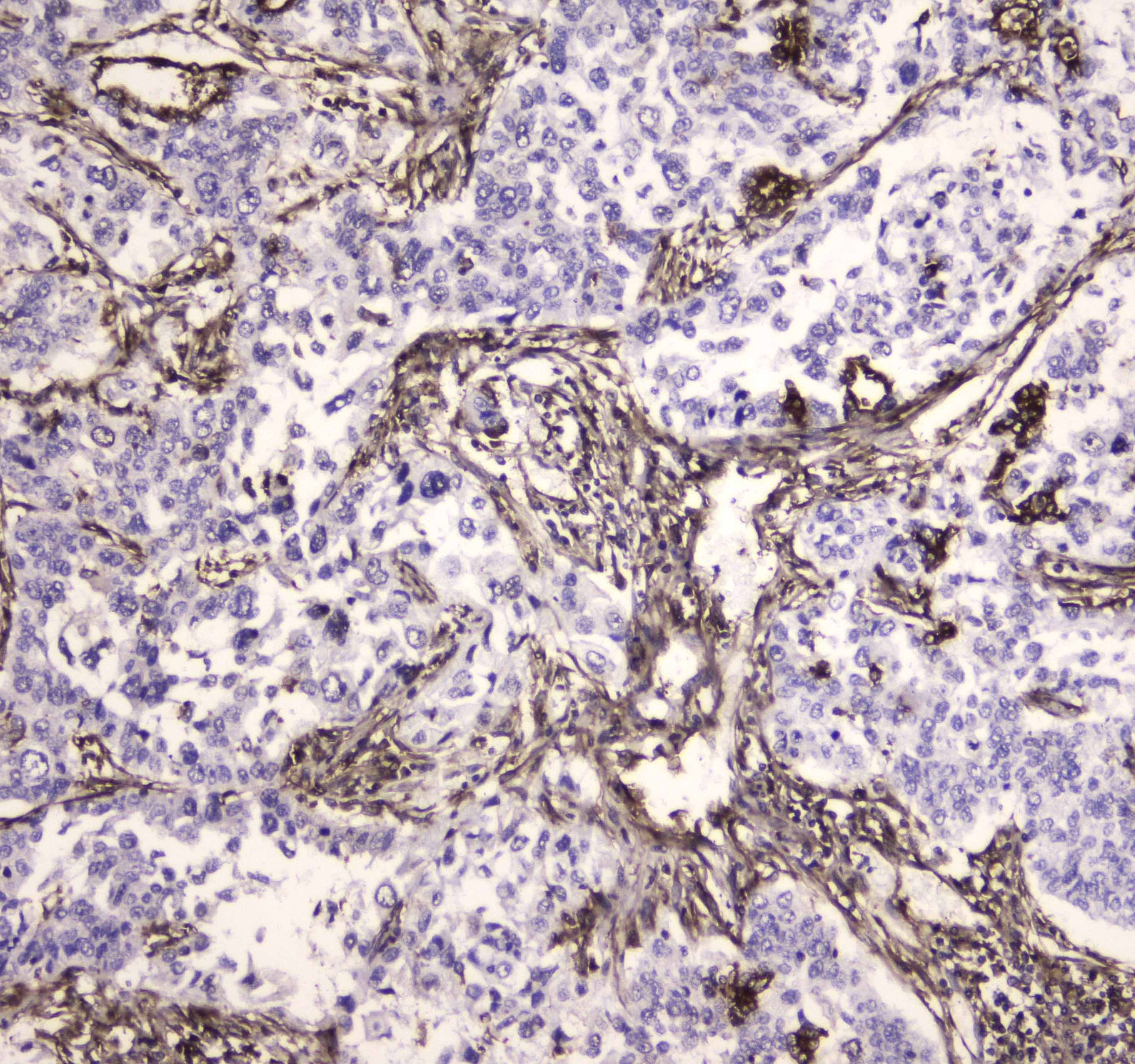 MVP / VAULT1 Antibody