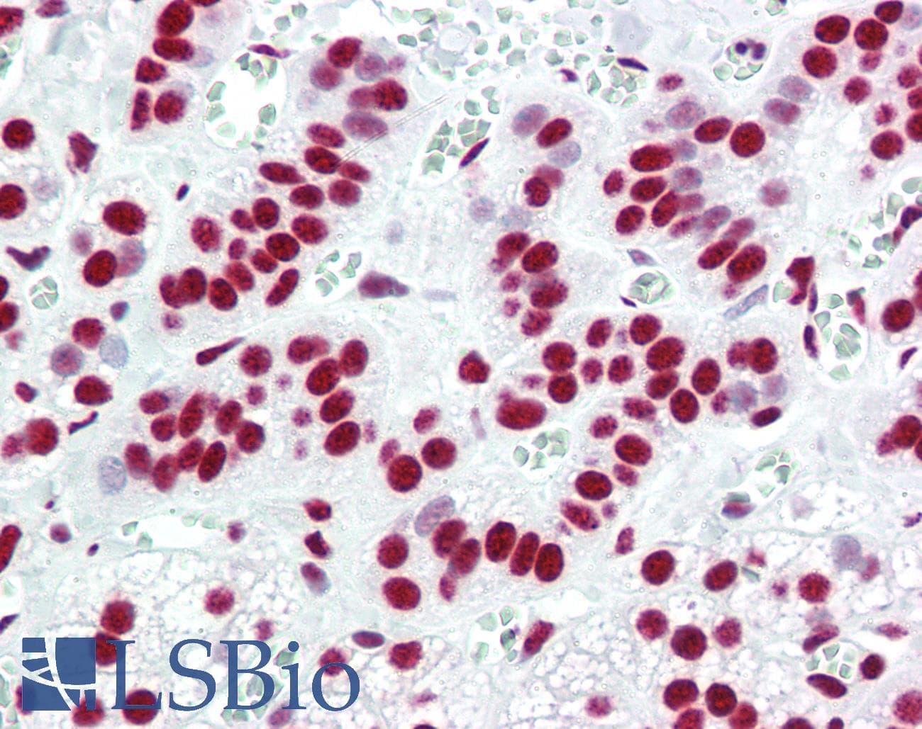 PathPlus™ ACIN1 / Acinus Antibody