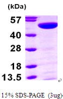 Human TP / Thymidine Phosphorylase Protein (Recombinant His)