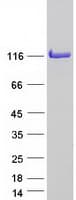 Human EIF3C / EIF3S8 Protein (Recombinant Myc-DDK (Flag))