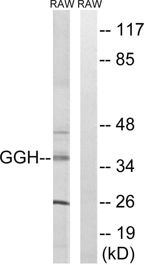 GGH / Gamma-Glutamyl Hydrolase Antibody