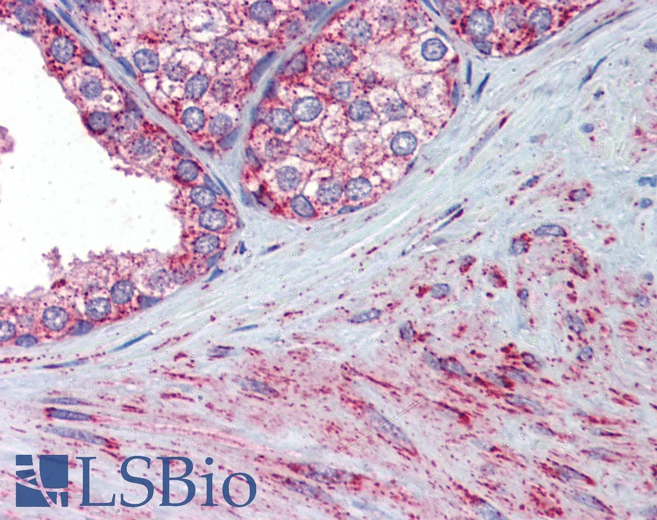 IHC-plus™ Polyclonal Rabbit anti-Rat SOD2 / Mn SOD Antibody (IHC, WB)