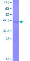Human SLC18A1 / VMAT1 Protein (Recombinant GST)