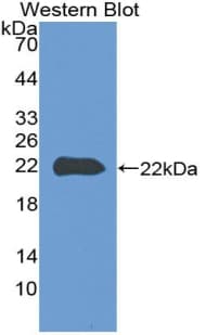 CLIC1 / NCC27 Antibody (aa79-241, FITC)