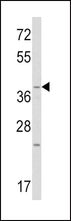 WNT1 Antibody (aa260-288)