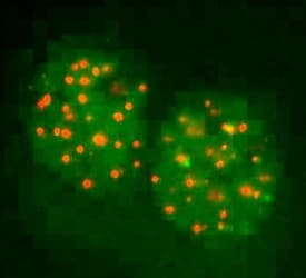 FANCD2 Antibody (N-Terminus, DY488)