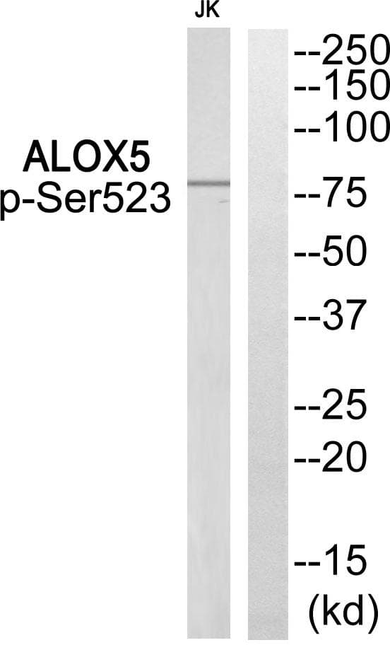ALOX5 / 5-LOX Antibody (phospho-Ser523)